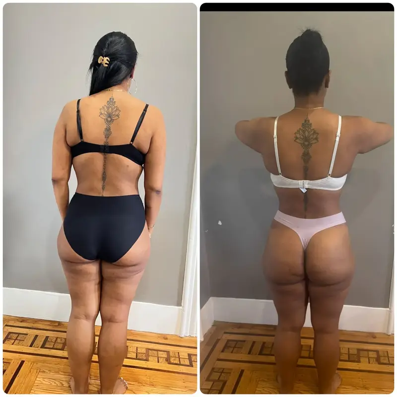 Transformacion de alumna - antes y despues espalda